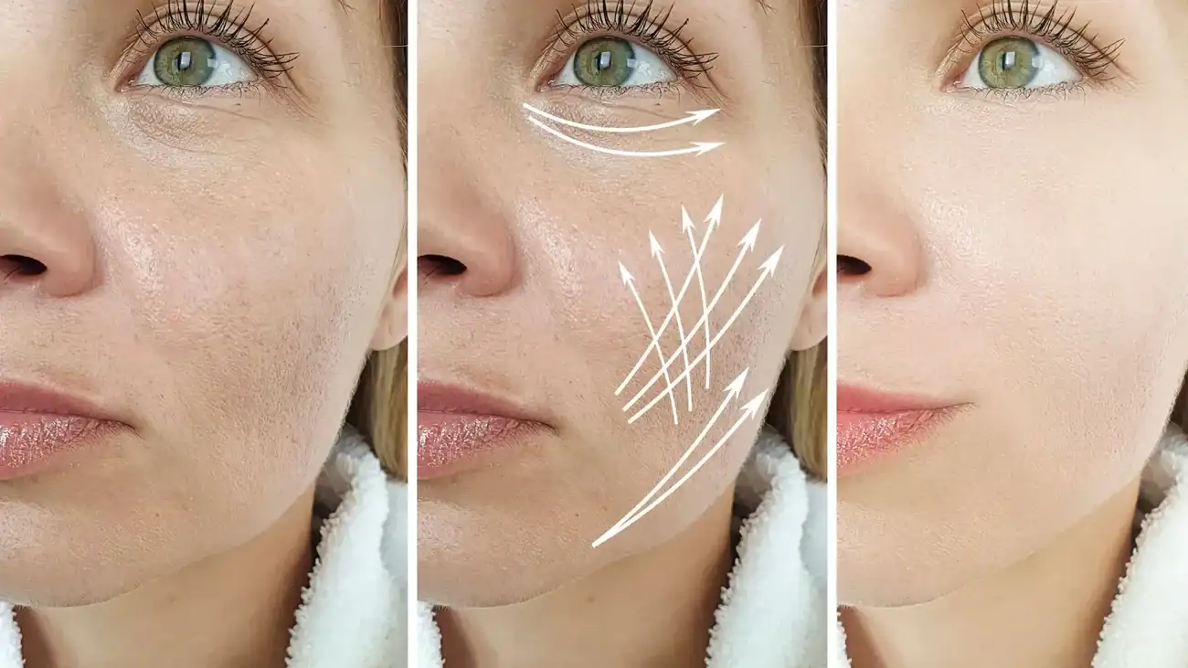 Can One Treatment Really Tackle More Than One Skin Concern Lincolnshire?