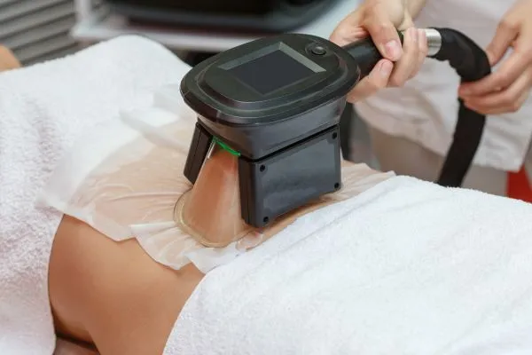 Image of person having fat freezing treatment to help weight gain Lincolnshire