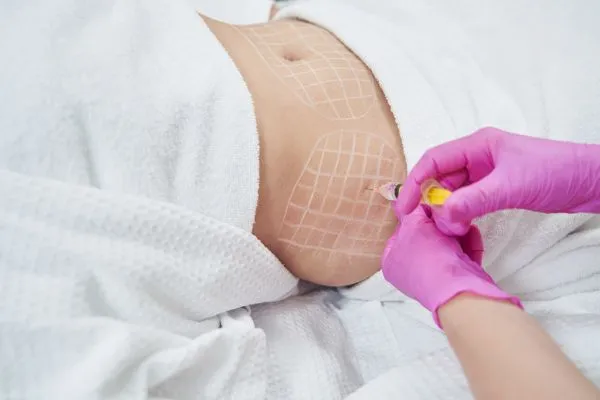 image of fat dissolving injections on love handles to help combat weight gain Lincolnshire