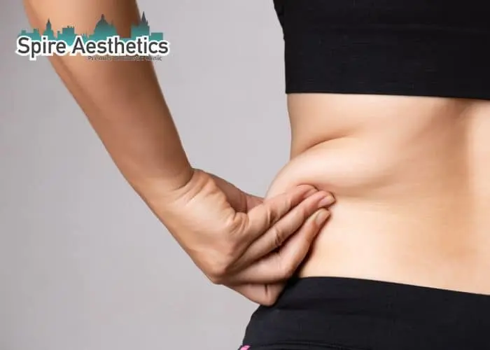 Image of woman pinching fat on their hips Lincolnshire. Fat Freezing treatment