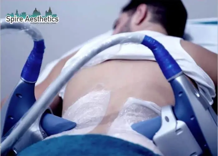 Man having fat freezing treatment done on love handles before a competitions Lincolnshire to create a sculpted look.