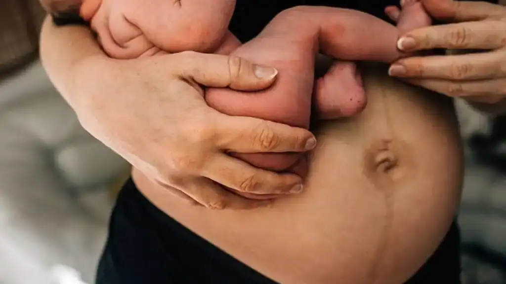 Why Is My Stomach Still Big After Pregnancy Lincolnshire?